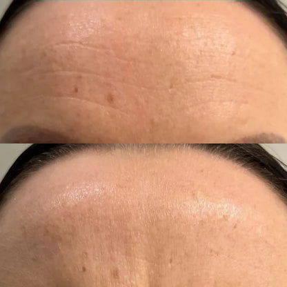 Crème Gelée Collagène | Hydratation First & Fermeté Visage - GLOWTHERAPY